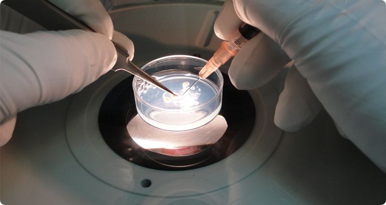 60% من الرجال في البلدان المتقدمة يعانون من انخفاض عدد الحيوانات المنوية