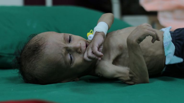 الطفلة شذوان وهيب رضوان