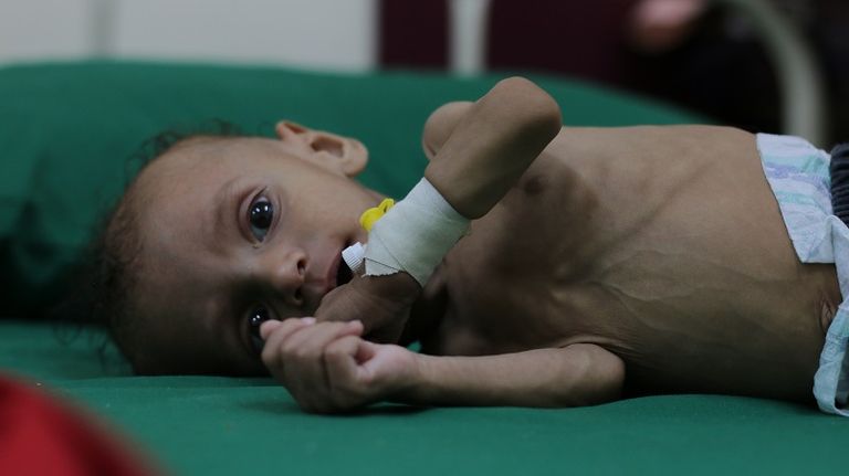 الطفلة شذوان وهيب رضوان