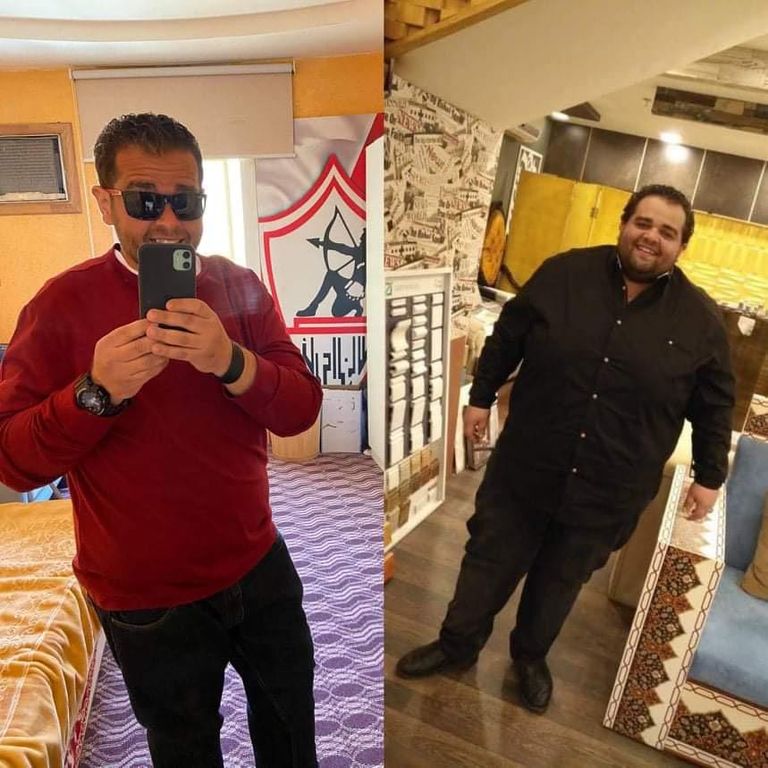 الشاب المصري وليد مؤمن قبل وبعد فقدان الوزن الزائد