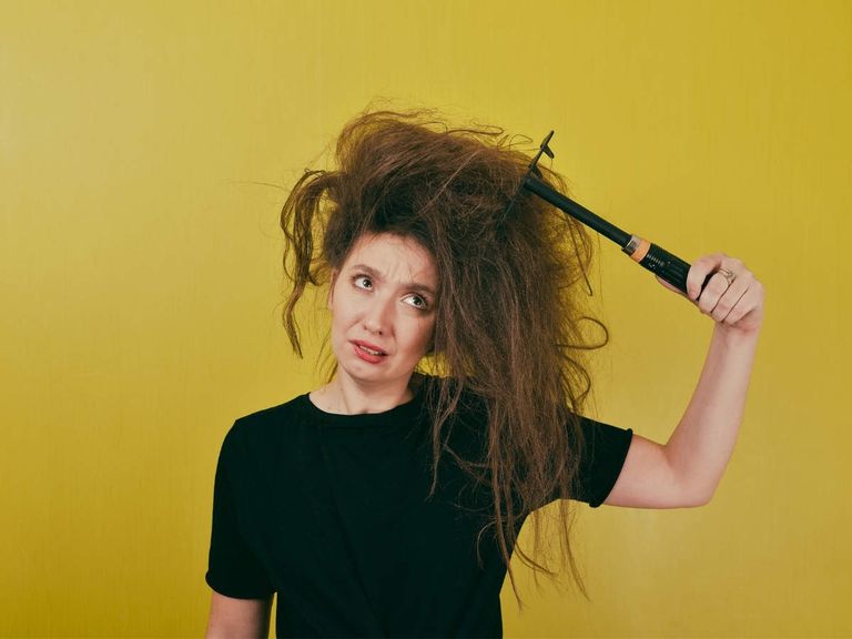 من أسباب قشور فروة الرأس الضغط الجسدي والعاطفي - أرشيفية