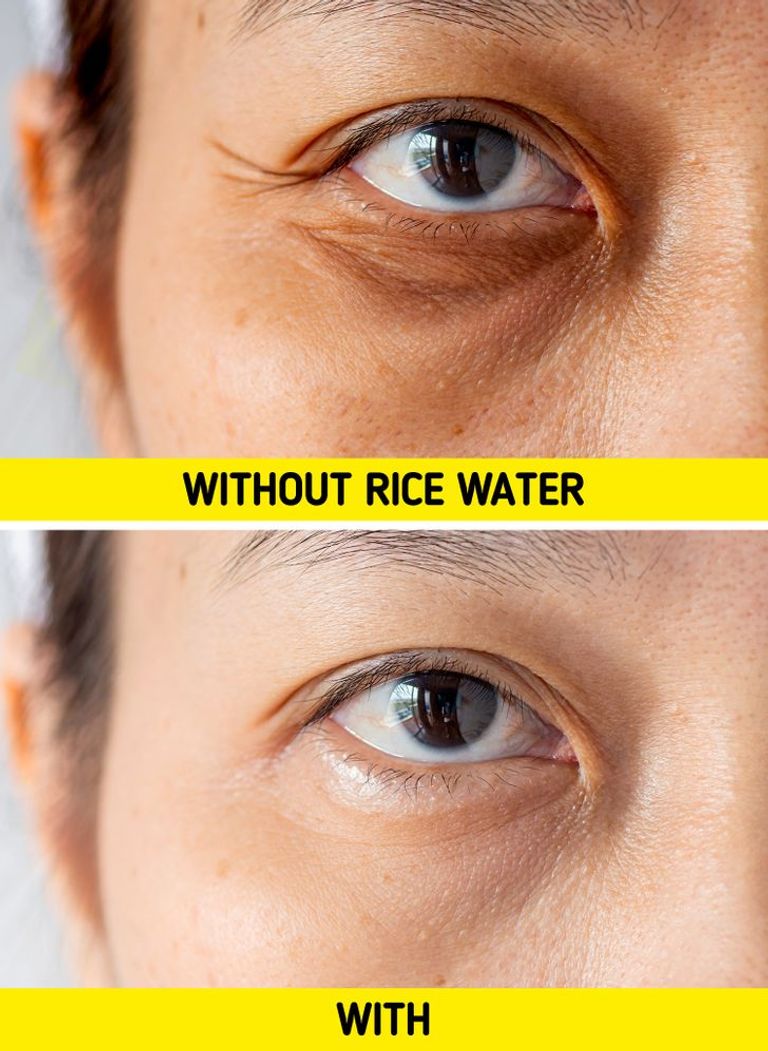 ماء الأرز.. فوائد سحرية لجمال وشباب البشرة