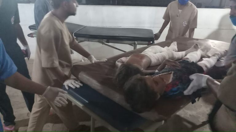 إصابة أطفال يمنيين في انفجار اللغم