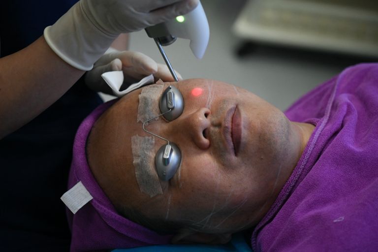 عمليات التجميل تستهوي الرجال في الصين