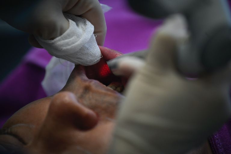 عمليات التجميل تستهوي الرجال في الصين