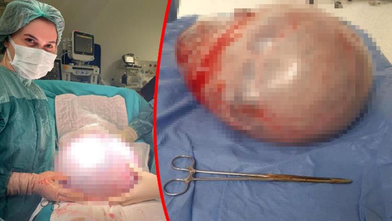 أطباء يجرون جراحة (أرشيفية)