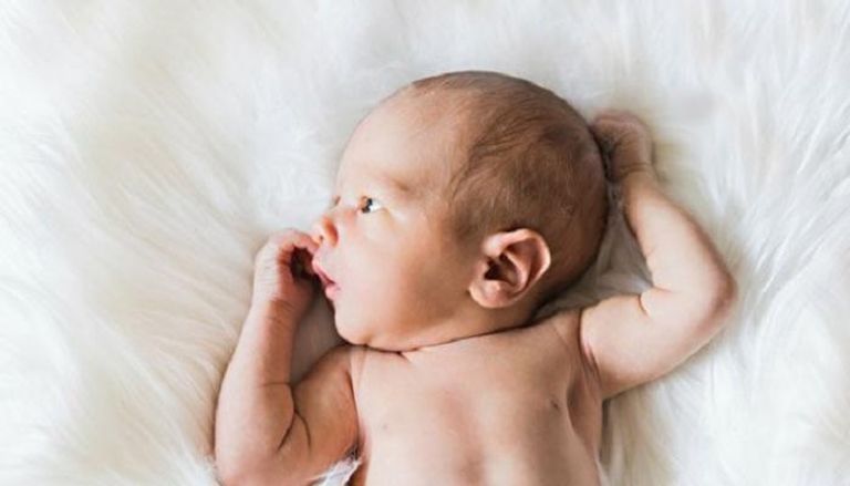 رتق القناة الصفراوية يصيب الأطفال حديثي الولادة