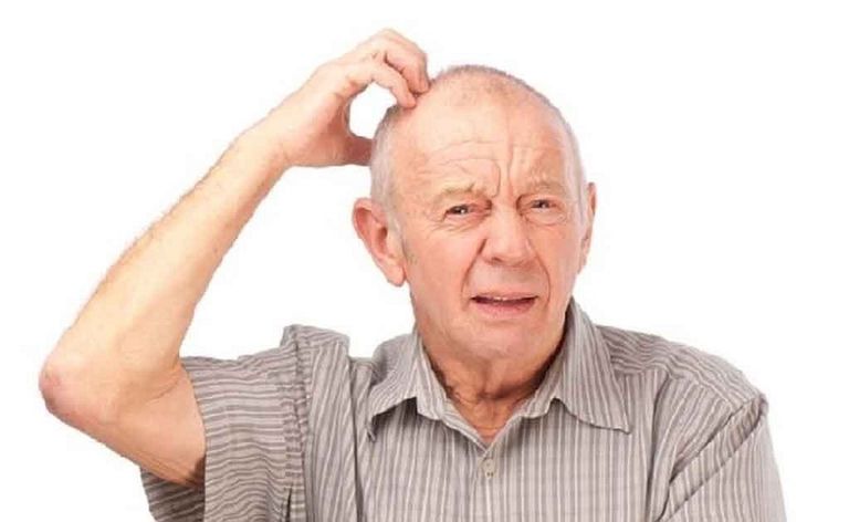 مرض ألزهايمر يصيب كبار السن غالباً- أرشيفية