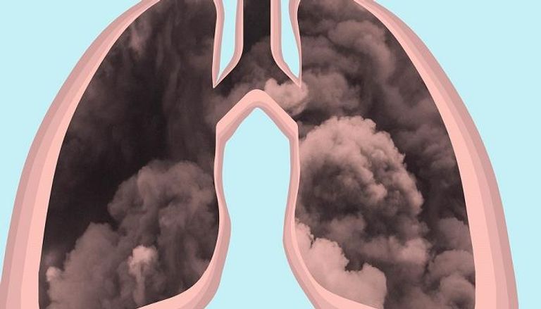 التعرض طويل الأمد لتلوث الهواء يزيد خطر الإصابة بكورونا