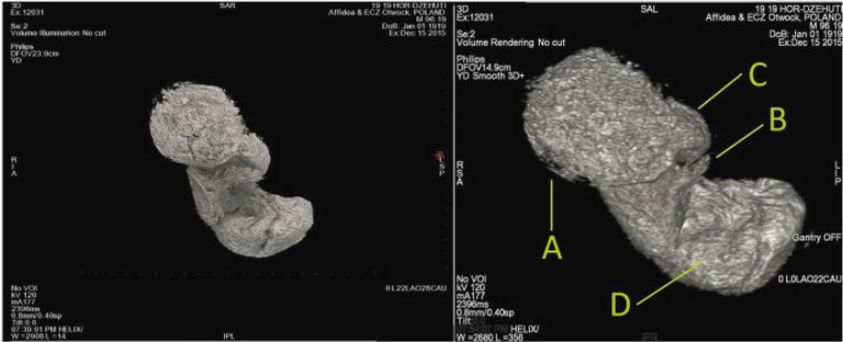 الفريق البحثي ومعاونوهم من العاملين على فحص المومياء الحامل