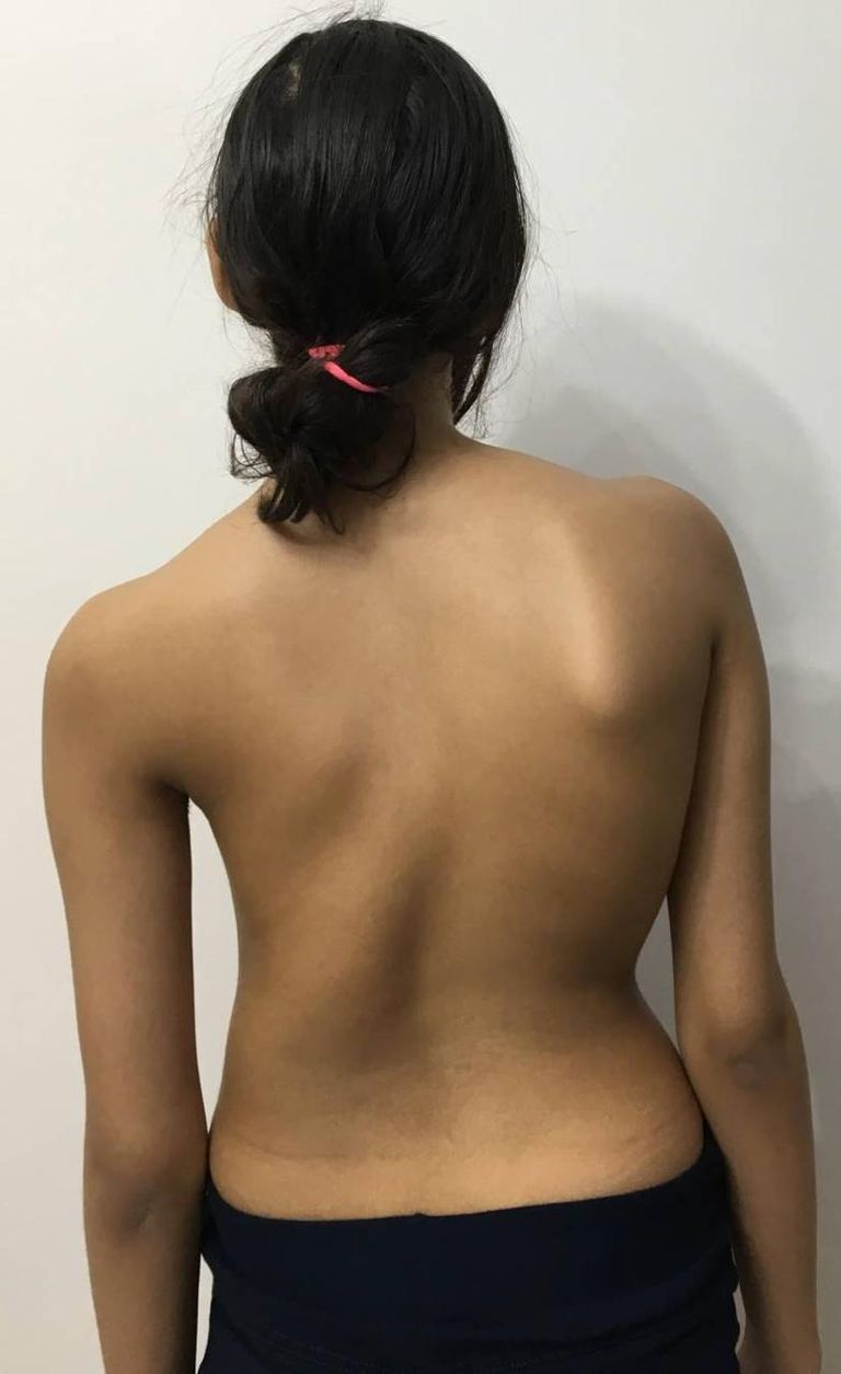 هاني عبدالجواد يتوسط صورة تبين الفرق بين حالة طفلة قبل وبعد العملية