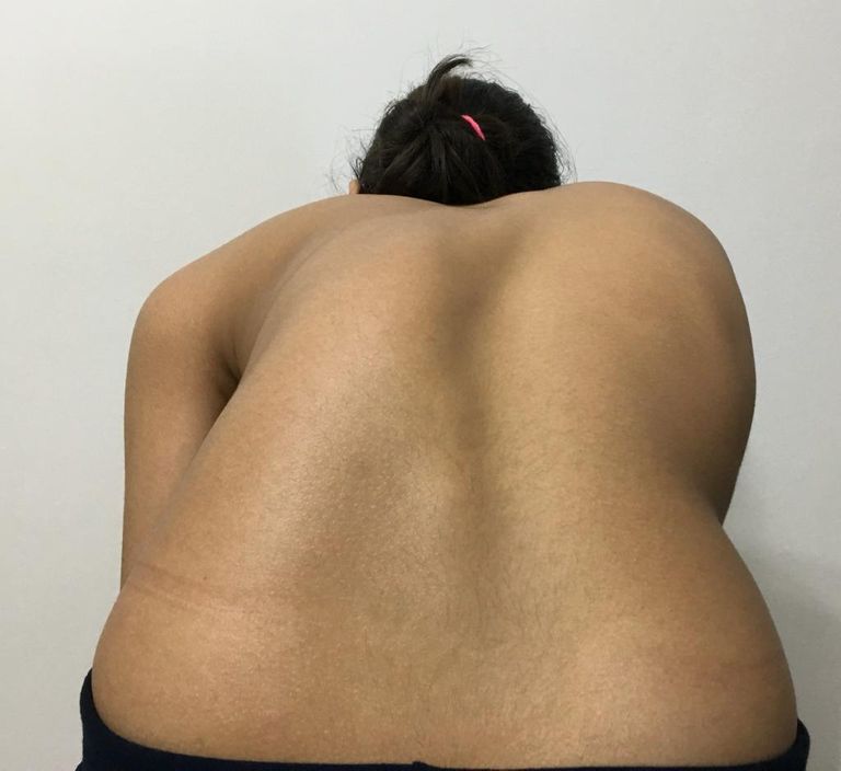 هاني عبدالجواد يتوسط صورة تبين الفرق بين حالة طفلة قبل وبعد العملية