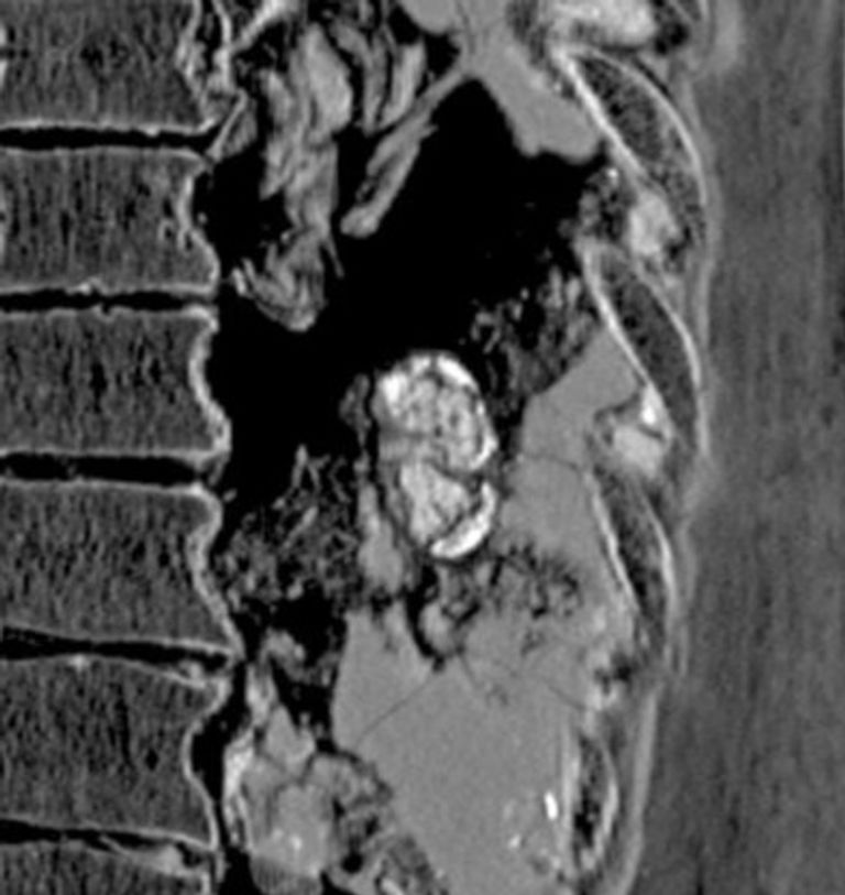 المومياء التي أجريت عليها الدراسة كانت محفوظة في كارتوناج 