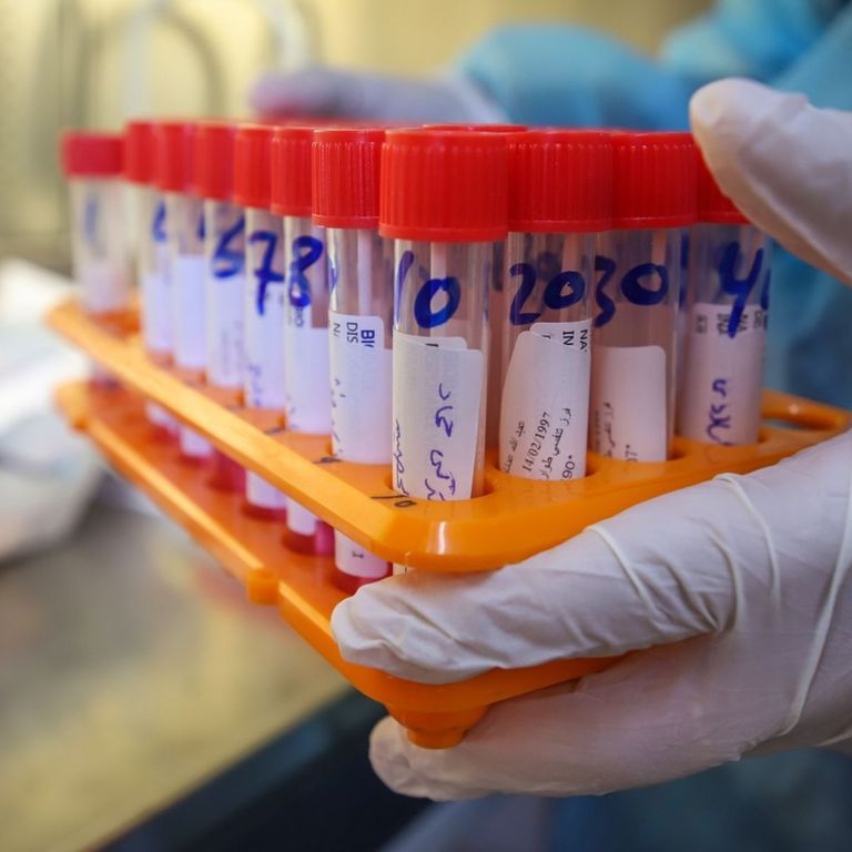 متحور أوميكرون تم اكتشافه في نهاية نوفمبر 2021 بجنوب أفريقيا