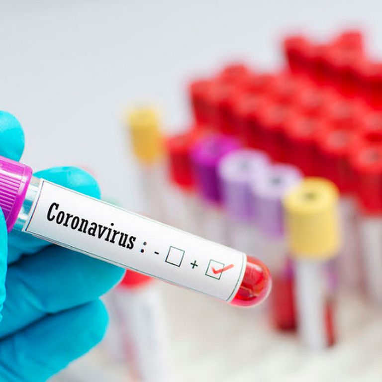 المغنية التشيكية هانا هوركا