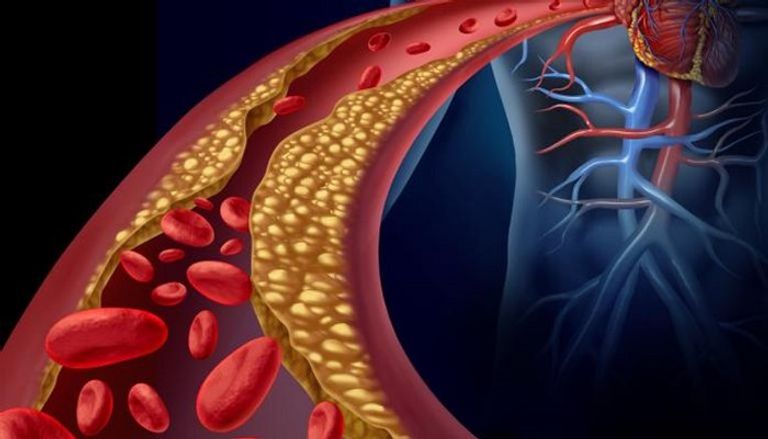 أصابع القدمين تعطي مؤشرا عن ارتفاع الكوليسترول