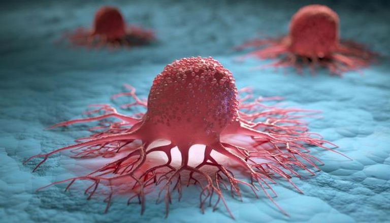 خلايا سرطانية- صورة تعبيرية