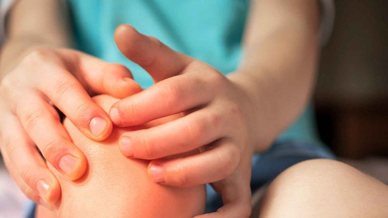 اليوم العالمي لالتهاب المفاصل - أرشيفية