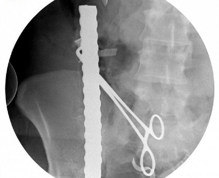 المدينة الطبية بجامعة الملك سعود - أرشيفية