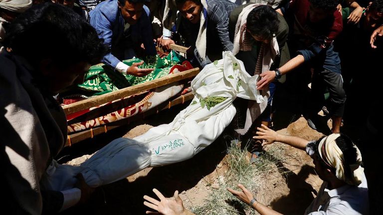 الأب لم يتحمل رحيل ابنه بدواء فاسد في اليمن 