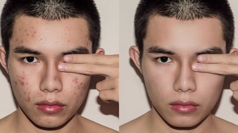 فوائد صحية للتوقف عن تناول السكر