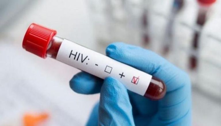 اختبار فيروس الإيدز