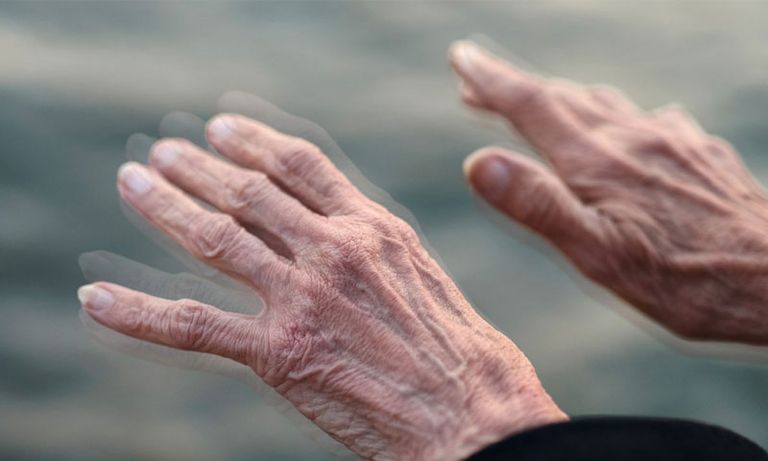 اهتزاز اليدين أبرز أعراض الشلل الرعاش الفنان المصري يوسف فوزي - أرشيفية