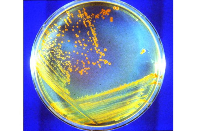 البكتيريا تم تعريضها لظروف المريخ لاختبار إمكانية بقائها