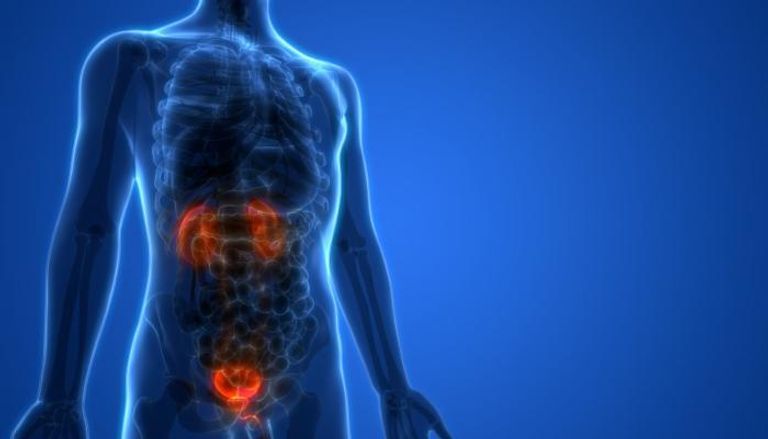 سرطان المثانة يصيب الرجال بمعدل أكبر من النساء