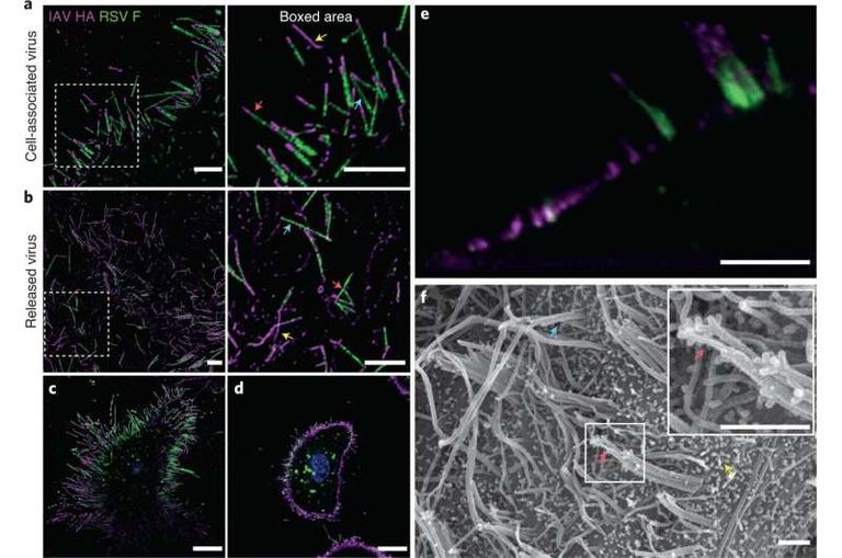 سيدة تعاني من نزلة برد - تعبيرية