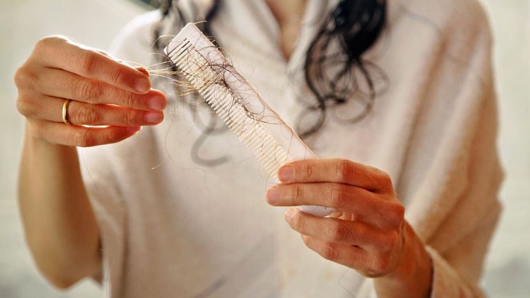 أفضل فيتامين لتساقط الشعر أفضل فيتامين للشعر  الصحي