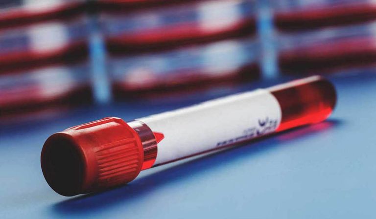 فصائل الدم- أرشيفية