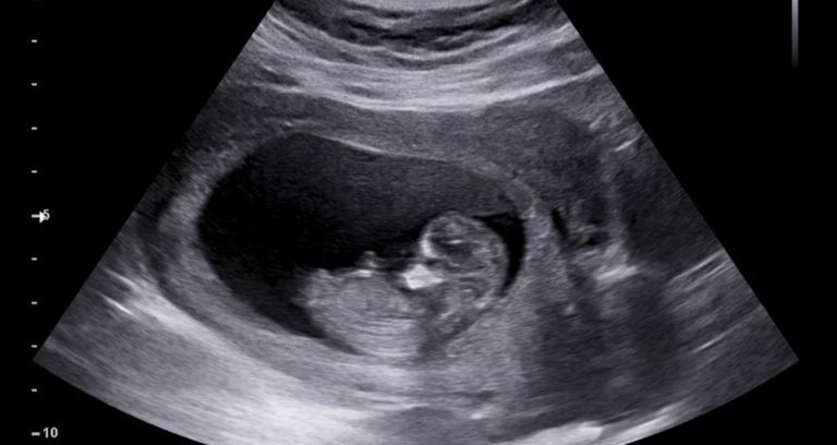 امرأة حامل- أرشيفية