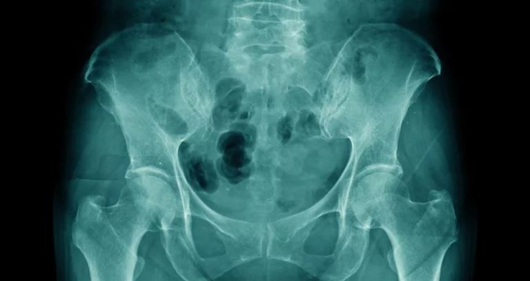 امرأة حامل- أرشيفية