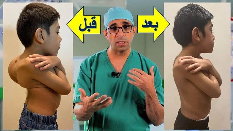 إحدى الجراحات الصعبة التي أجراها د.هاني عبدالجواد