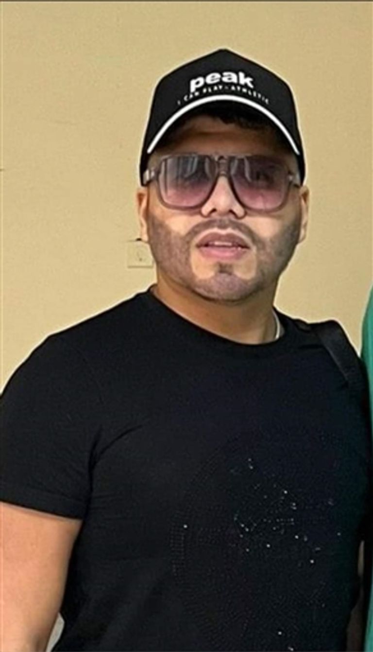 عمر كمال بعد زراعة لحيته عمر كمال - أرشيفية