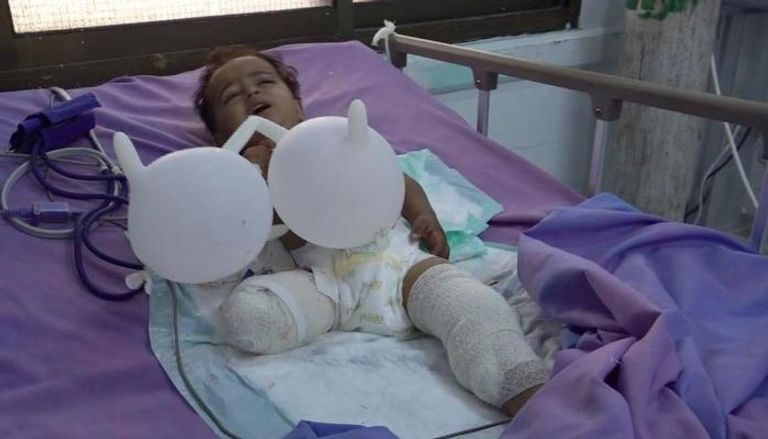 إحدى ضحايا هجمات الحوثي