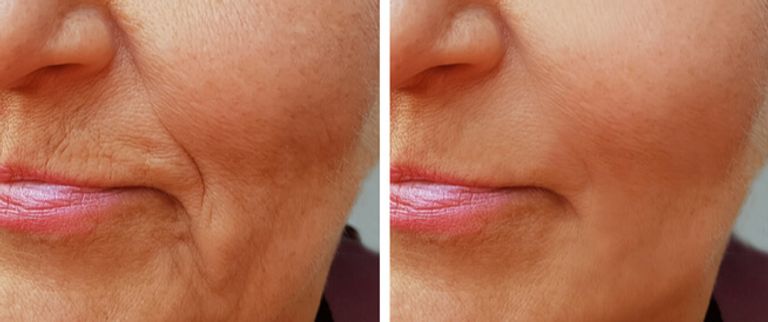 مكملات الكولاجين -تعبيرية