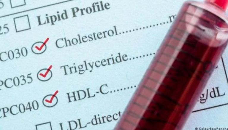 الكوليسترول الضار سبب رئيسي لأمراض القلب