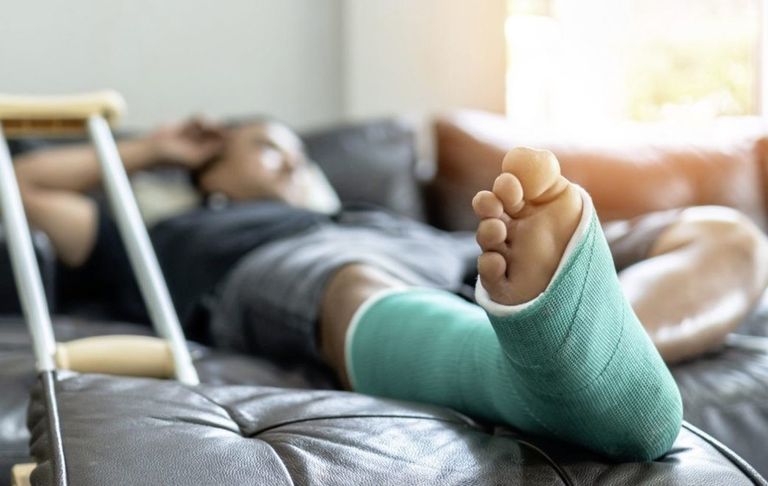 سيدة مصابة بكسور في العظام - أرشيفية