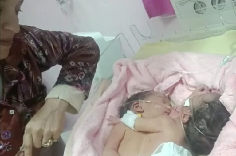 التوأم إيمان وأمينة