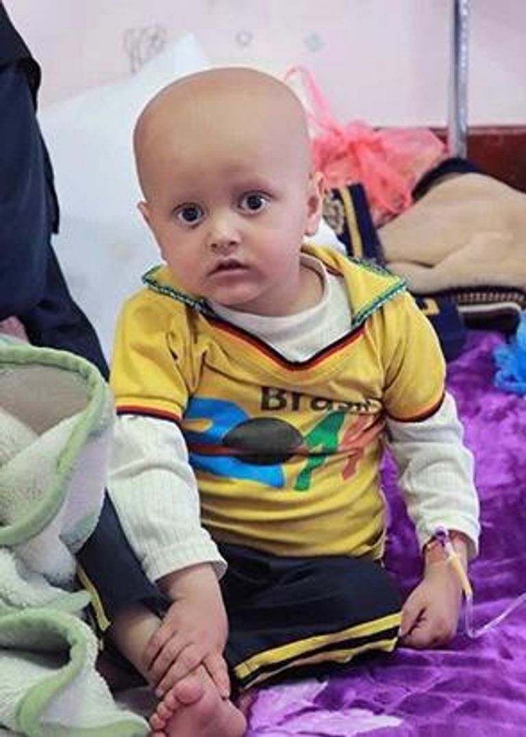 أحد مرضى السرطان في اليمن- أرشيفية