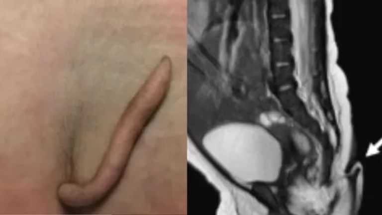 صورة تعبيرية