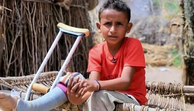 طفل أحد ضحايا ألغام مليشيات الحوثي- أرشيفية
