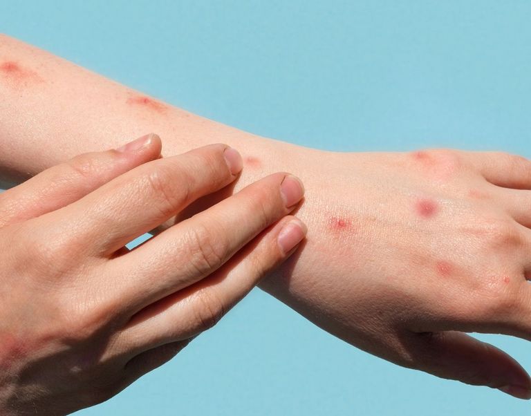 مريضة تخضع للفحص الطبي - أرشيفية