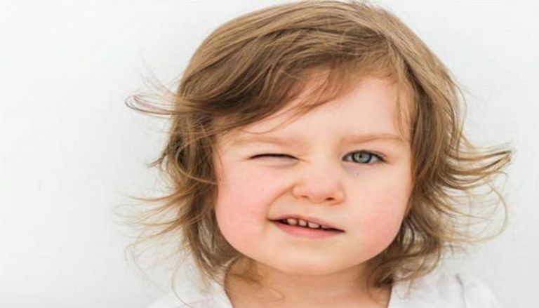 معظم حالات شلل الوجه لدى الأطفال تكون غير ضارة - أرشيفية