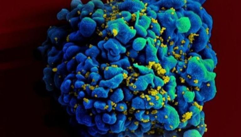 خلية بشرية مصابة بفيروس الإيدز