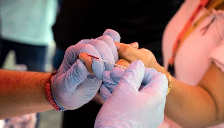 خلية بشرية مصابة بفيروس الإيدز