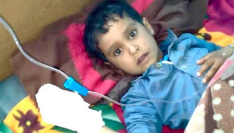 طفل مصاب بفخاخ الحوثي بمأرب