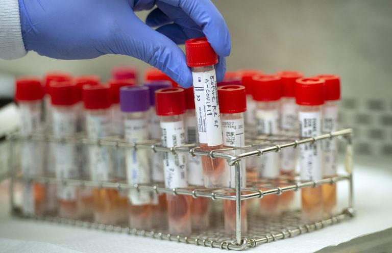 مريضة كوفيد-19